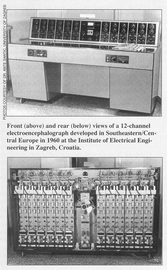 Elektroencefalograf